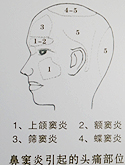 湘潭市雨湖区庞氏中医诊所,湘潭耳鼻喉肿瘤防治 湘潭市雨湖区庞氏中医诊所,湘潭耳鼻喉肿瘤防治